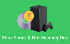 Xbox Series X läser inte skiva