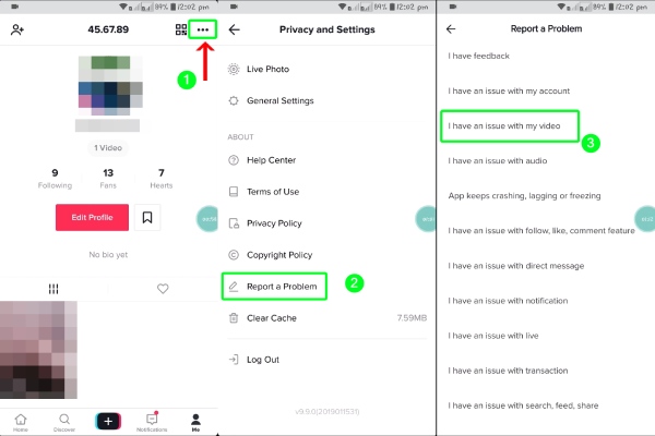 Αναφορά προβλήματος TikTok Τεχνική υποστήριξη